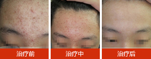 南京华肤医院